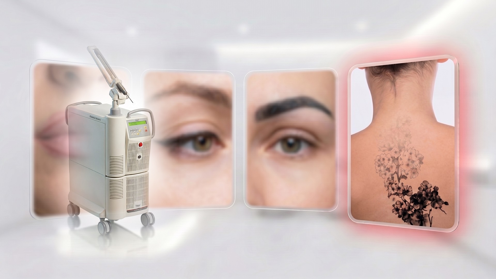 1_tattoo removal header test1