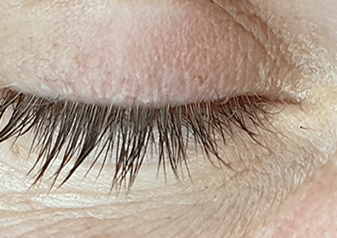 eyetaga1