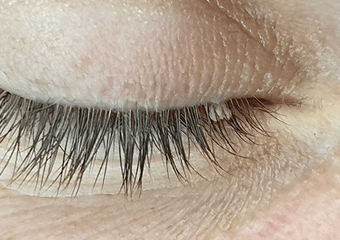 eyetagb1