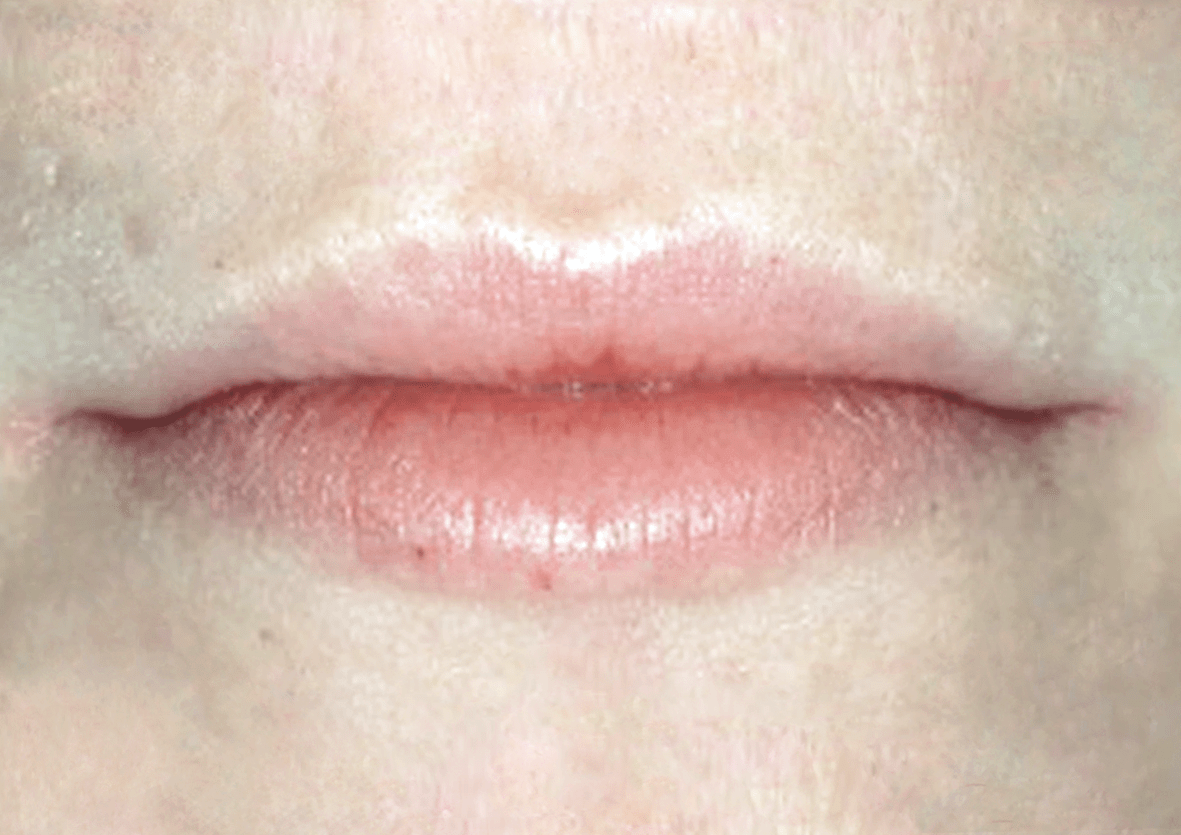 lips1-a2