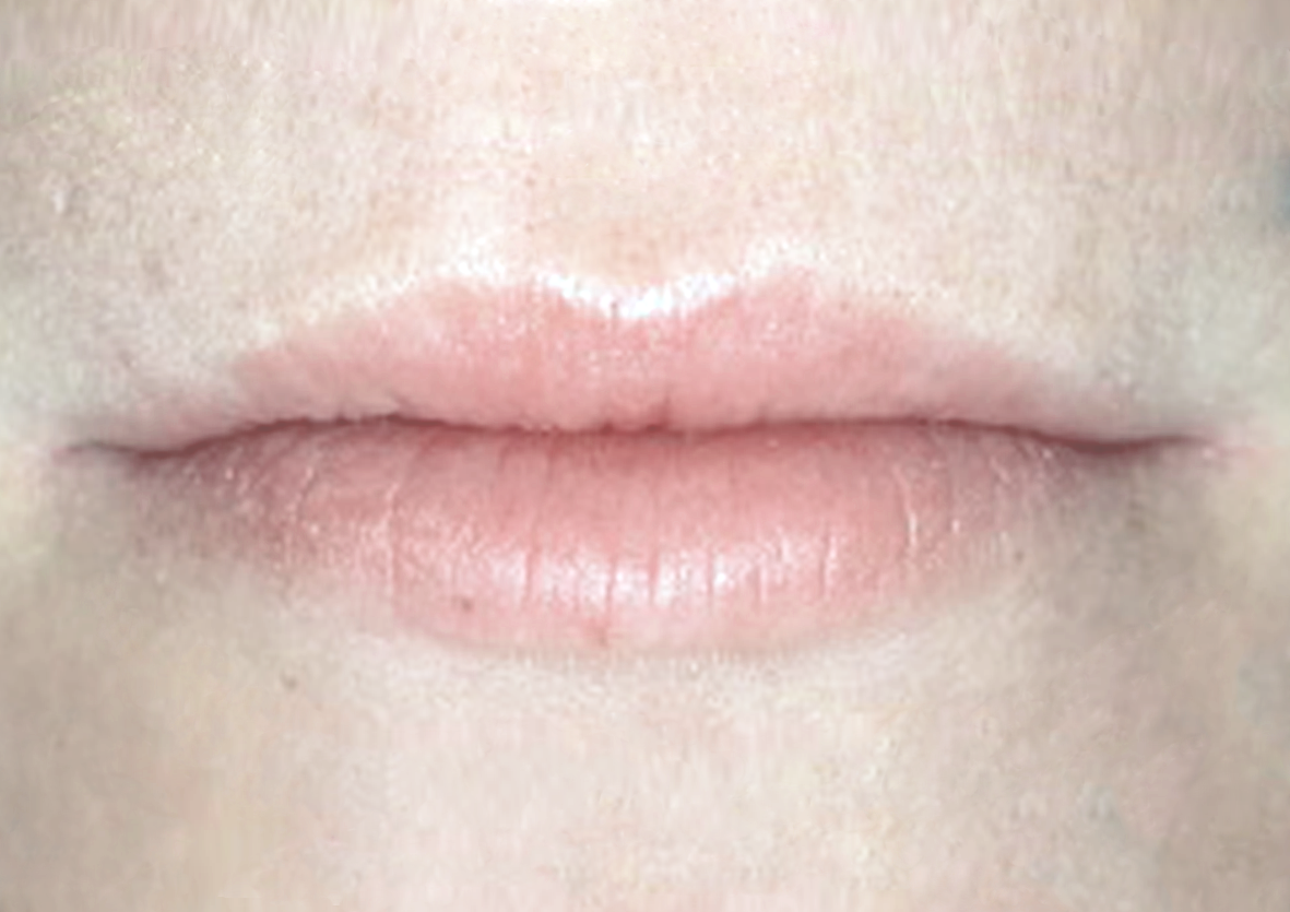 lips1-b2
