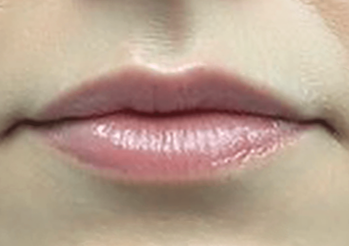 lips2-a2