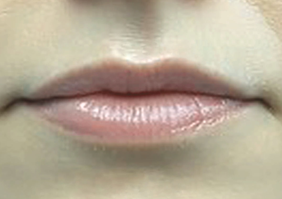 lips2-b2