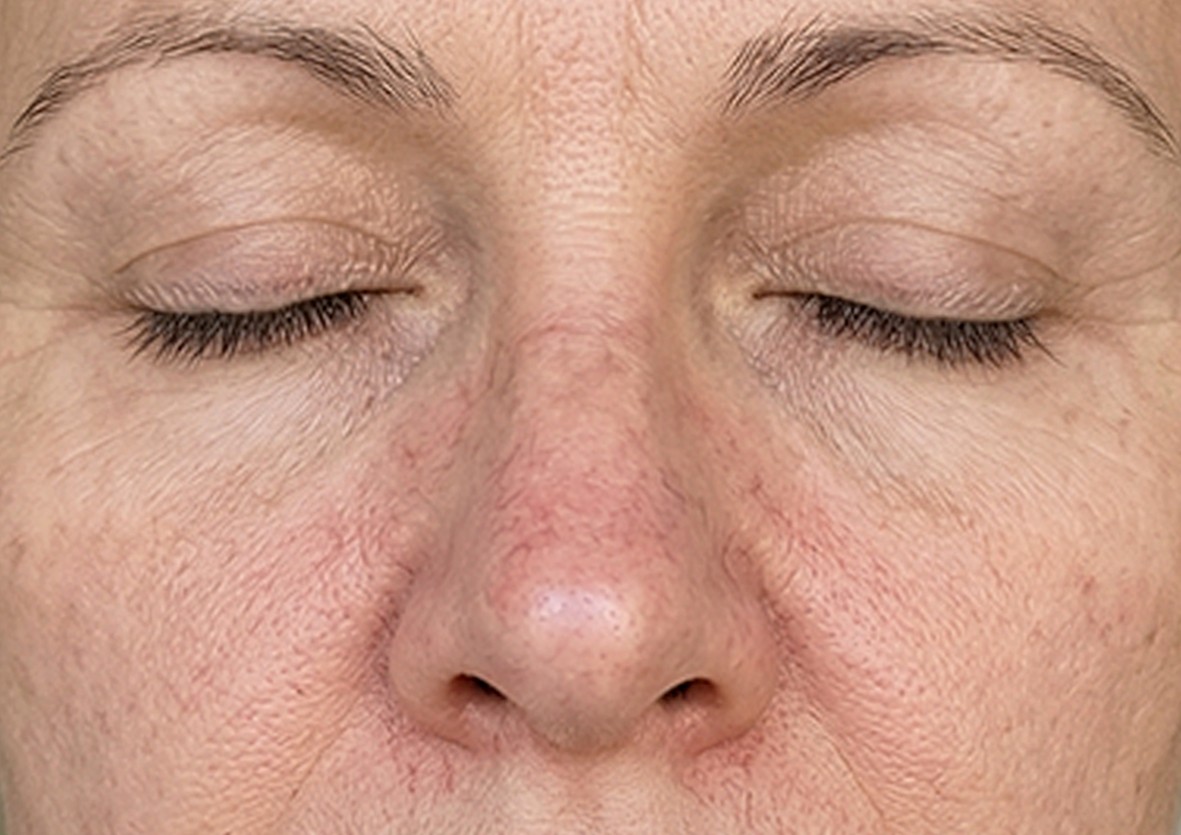 vascufaceft b1