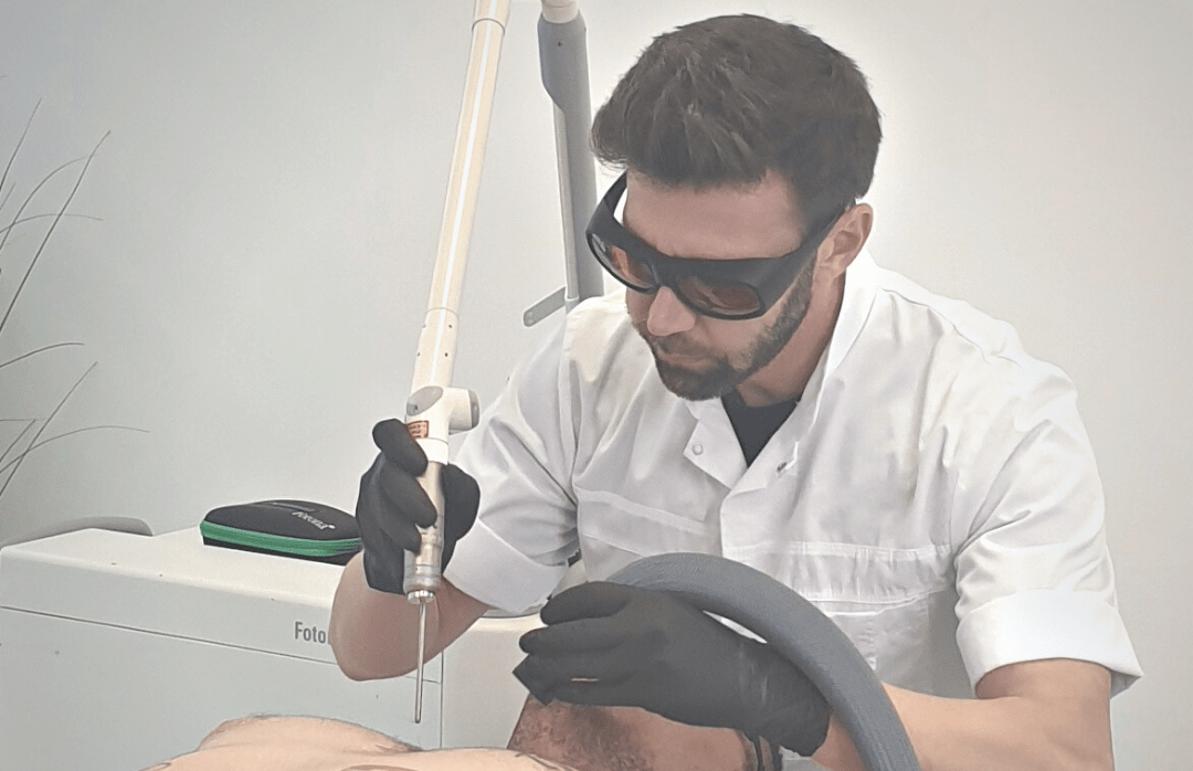 הסרת-קעקועים-בלייזר לבן